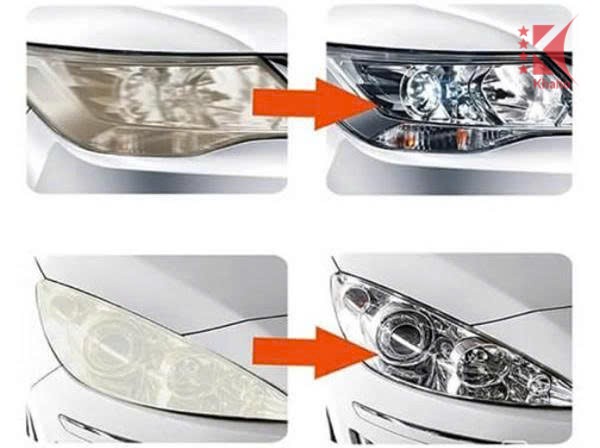 truong hop nen va khong nen can thiep